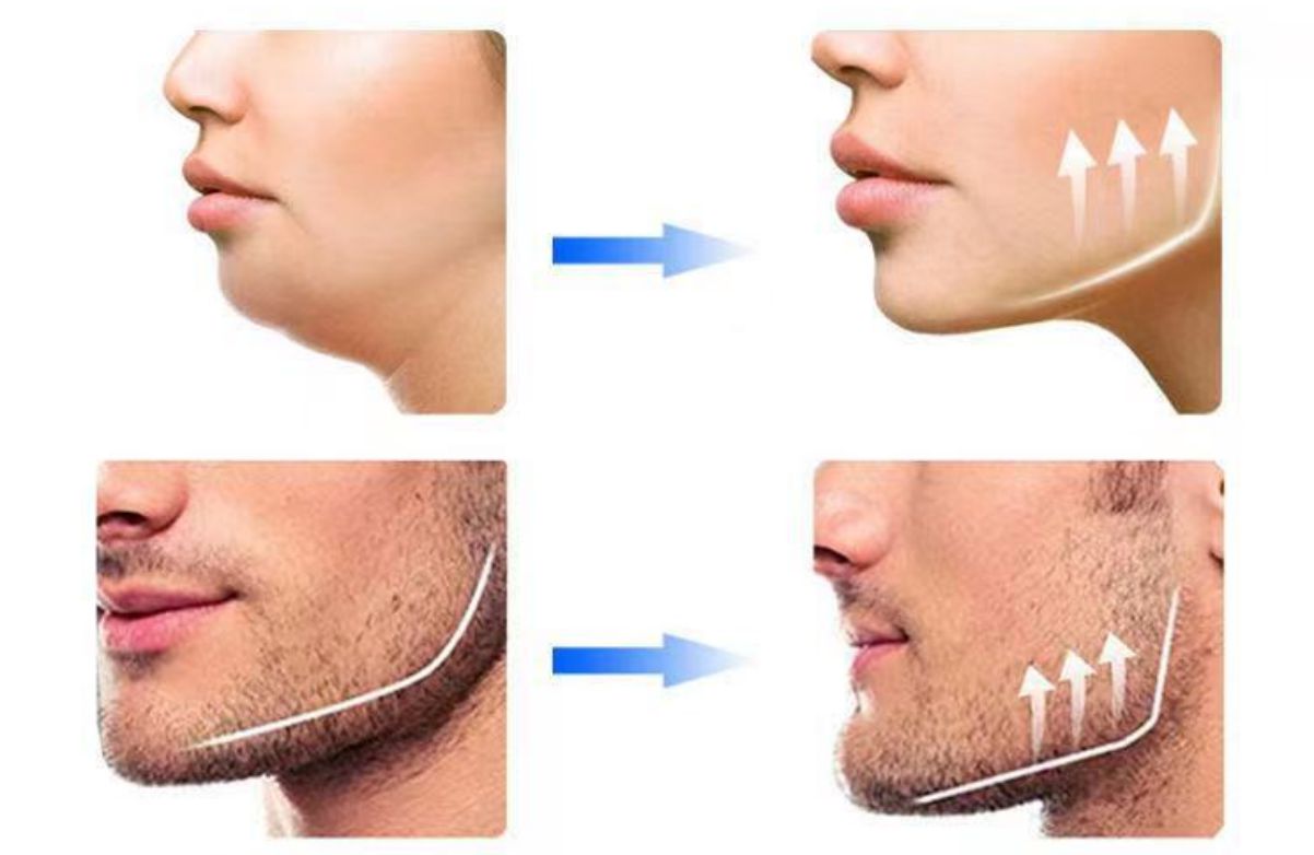 행복 지수 향상-쥬얼 라인 트레이너 제조 업체-와서 우리를 선택하십시오